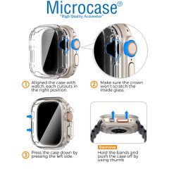Microcase Apple Watch Ultra 49mm Önü Kapalı Silikon Kılıf - AL3173