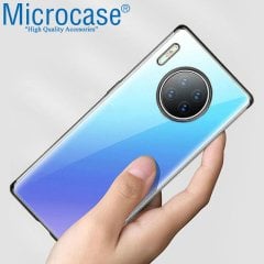 Microcase Huawei Mate 30 Plating Series Silikon Kılıf - Siyah