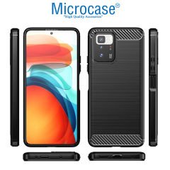 Microcase Xiaomi Redmi 10 - Redmi 10 Prime Brushed Carbon Fiber Silikon Kılıf - Siyah