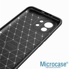 Microcase Xiaomi 11 Lite 5G NE Brushed Carbon Fiber Silikon Kılıf - Siyah