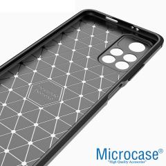 Microcase Xiaomi Redmi Note 11 Brushed Silikon Kılıf - Siyah