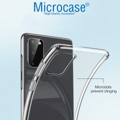Microcase Samsung Galaxy S20 0.2 mm Ultra İnce Soft Silikon Kılıf - Şeffaf