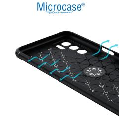 Microcase Oppo A16 Focus Serisi Yüzüklü Kılıf - Siyah