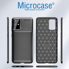 Microcase Samsung Galaxy S20 Maxy Serisi Carbon Fiber Silikon TPU Kılıf - Siyah