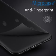 Microcase Xiaomi Mi 11 Ultra Elektrocase Serisi Kamera Korumalı Silikon Kılıf - Siyah