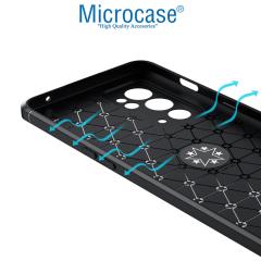 Microcase OnePlus 9RT 5G Focus Serisi Yüzüklü Kılıf - Siyah