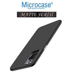 Microcase Xiaomi Redmi Note 10S Matte Serisi Silikon TPU Kılıf - Siyah