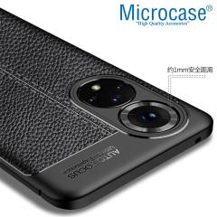 Microcase Huawei Nova 9 Leather Serisi Silikon Kılıf - Siyah