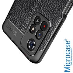 Microcase Xiaomi Redmi Note 11 Leather Serisi Silikon Kılıf - Siyah