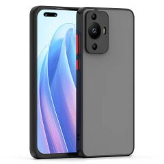 Microcase Huawei Nova 11 pro London Serisi Darbeye Dayanıklı Kılıf - Siyah AL3415