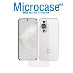Microcase Huawei Nova 11 Slim Serisi Soft TPU Silikon Kılıf - Şeffaf AL3324