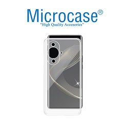 Microcase Huawei Nova 11 Pro Slim Serisi Soft TPU Silikon Kılıf - Şeffaf AL3324