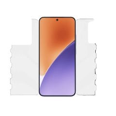 Microcase Xiaomi Mi 15 Ön Arka Yan Koruma Full Body Film - FL360