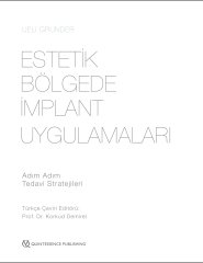 Estetik Bölgede İmplant Uygulamaları