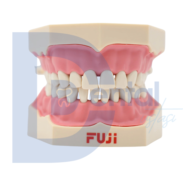 Fuji Diş Etli Çene