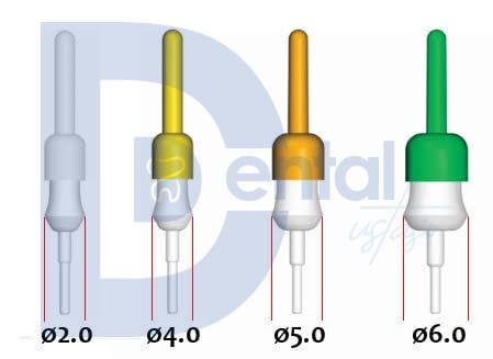Mega Dental Fibersite Post Set