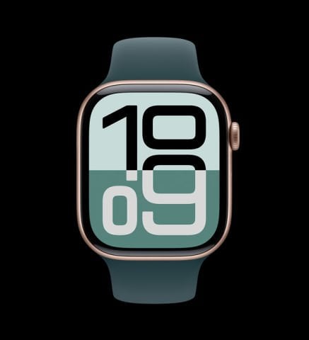 Apple Watch Series 10 Roze Altın