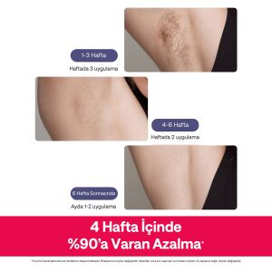 Ulike Air 2 Travel ED IPL Lazer Epilasyon Aleti Safir Buz Soğutma Teknolojisi