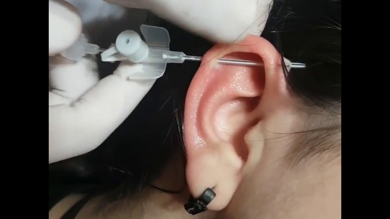 Information about piercings and are intracath