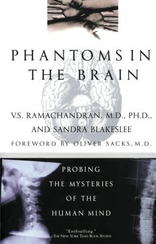 Phantoms in the Brain