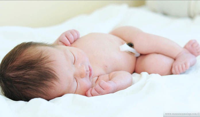 Yenidoğan Bebeklerde Göbek Bağı Bakımı