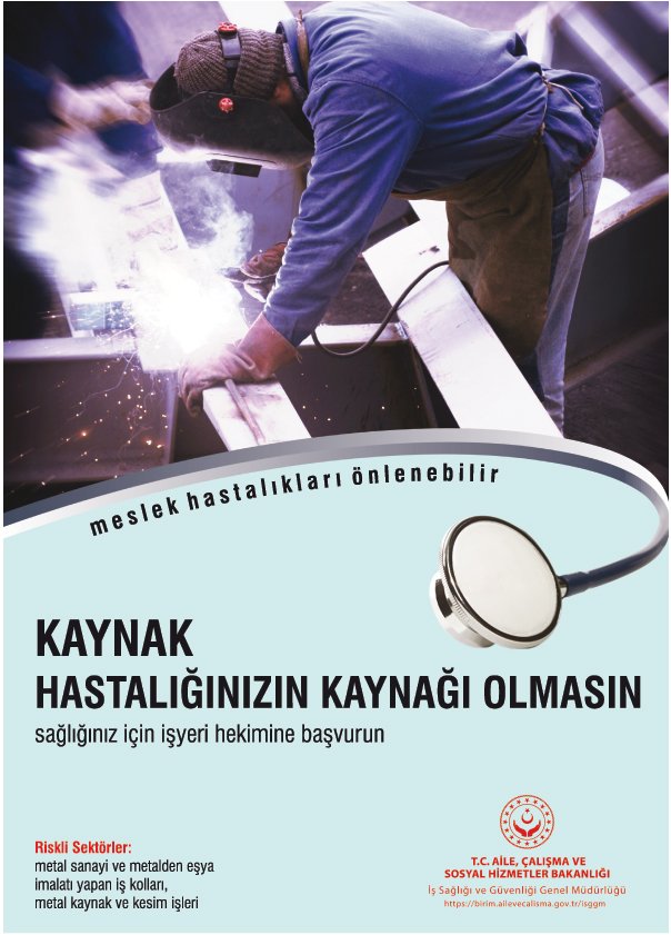 KAYNAK HASTALIĞINIZIN KAYNAĞI OLMASIN