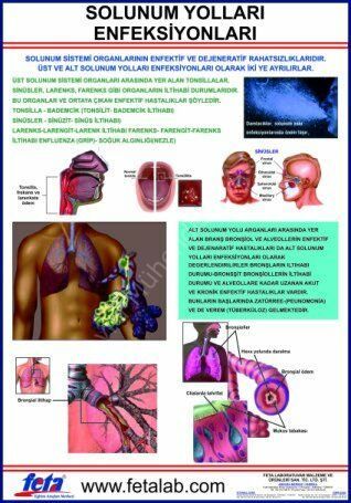 Solunum Yolları Enfeksiyonları Eğitim Plakası