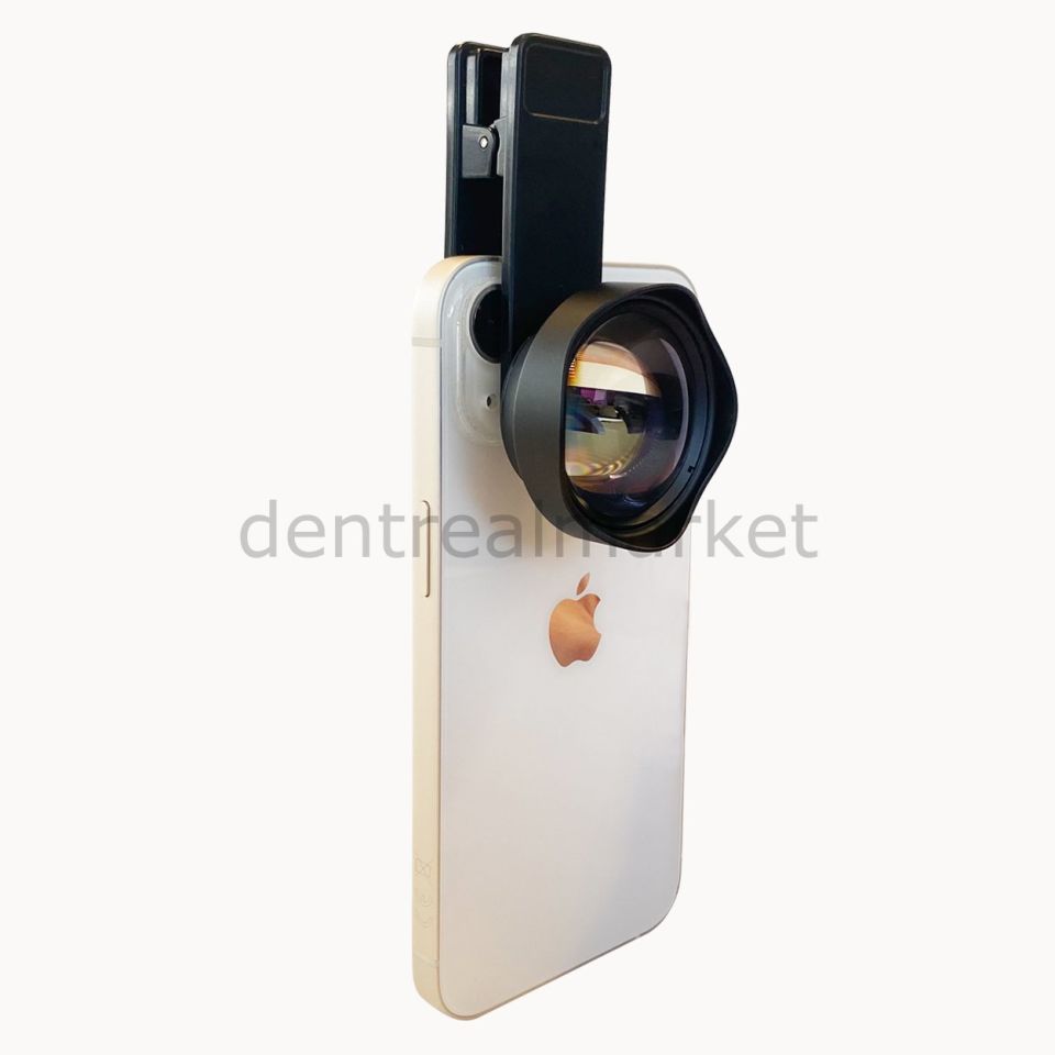 Dental Macro Telefon Lensi - 75 mm