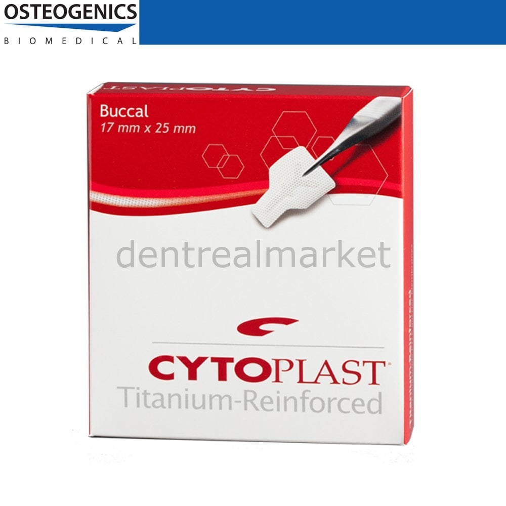 Cytoplast Titanyum Destekli Membran - 17x25 mm - Buccal