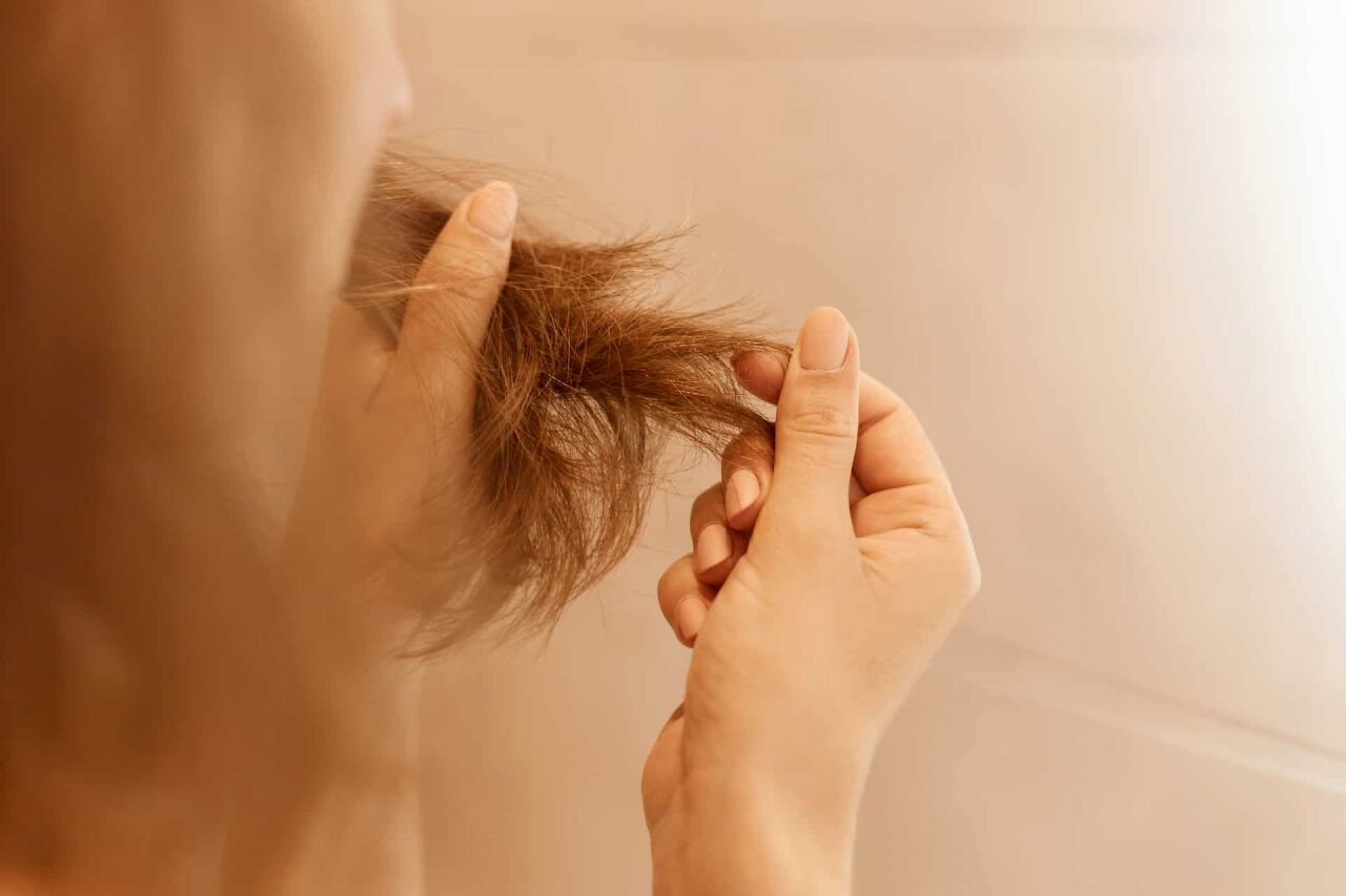 Saç Dökülmesine Karşı Çözüm Önerileri