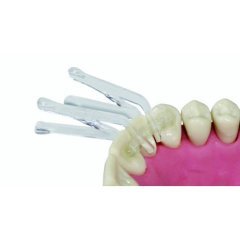 Fıber Splint Ortho Evolutıon