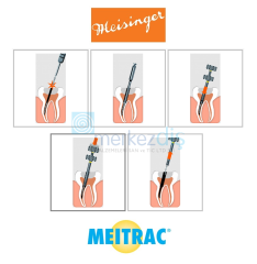 Meitrac II Endo Safety System Endo Kırık Eğe Çıkarma Sistemi