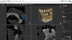 VistaVox S Dental Volumetrik Tomografi, Panoramik Röntgen Sistemi