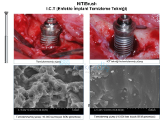 Nitibrush Peri-İmplantitis Frez Seti 4'lü