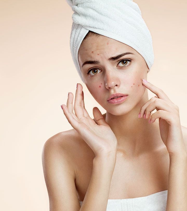 Temiz Bir Cildin Kilidini Açmak İstermisin : Akne İçin Retinol Nasıl Kullanılır ?