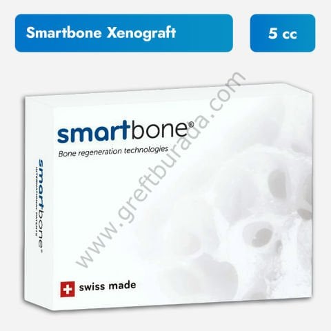 SmartBone Sığır Kaynaklı Kemik Grefti 2 Gr