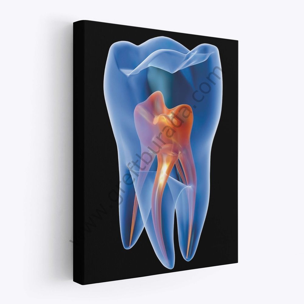 Dental -Tablo Tooth Anatomy 50X70 Kanvas Tablo