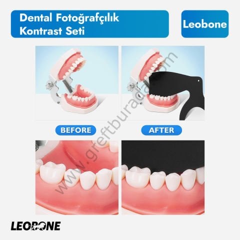 Otoklavlanabilir Dental Fotoğrafçılık Kontrast Plaka Seti