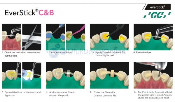 EverStick C&B 1 x 8 cm