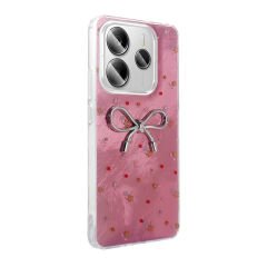 Xiaomi Redmi Note 14 5G Kılıf Kamera Korumalı Figürlü Ponti Silikon Kapak