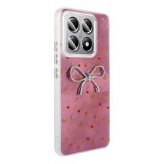 Xiaomi 14T Pro Kılıf Kamera Korumalı Figürlü Ponti Silikon Kapak