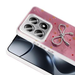 Xiaomi 14T Pro Kılıf Kamera Korumalı Figürlü Ponti Silikon Kapak