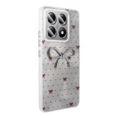 Xiaomi 14T Kılıf Kamera Korumalı Figürlü Ponti Silikon Kapak