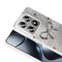 Xiaomi 14T Kılıf Kamera Korumalı Figürlü Ponti Silikon Kapak