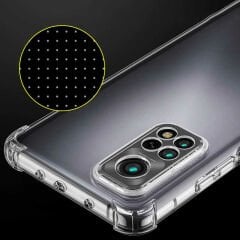 Xiaomi Redmi Note 11S Global Kılıf Nitro Anti Shock Darbe Emici Köşe Korumalı Şeffaf Silikon Kapak