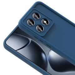 Xiaomi 14T Kılıf Kamera Korumalı Ananas Kapak