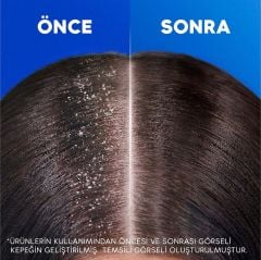 Head & Shoulders Limon Ferahlığı Şampuan 330 ML