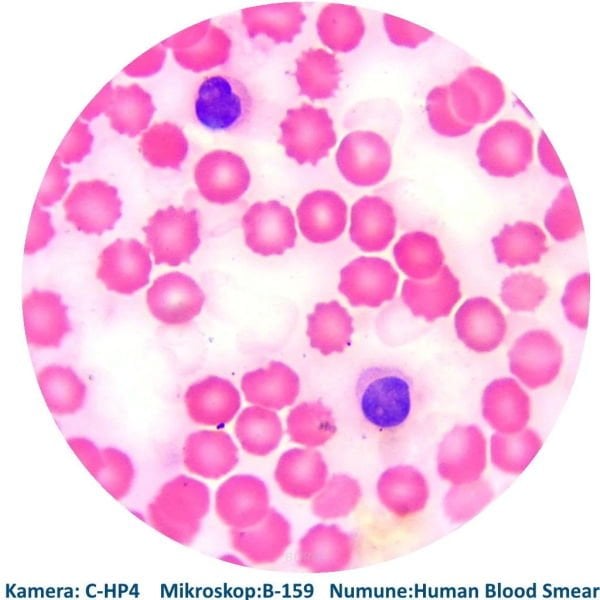 Hazır Mikroskop Slaytı - İnsan Kan Simiri Preparatı