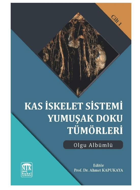 Kas İskelet Sistemi Yumuşak Doku Tümörleri Olgu Albümlü