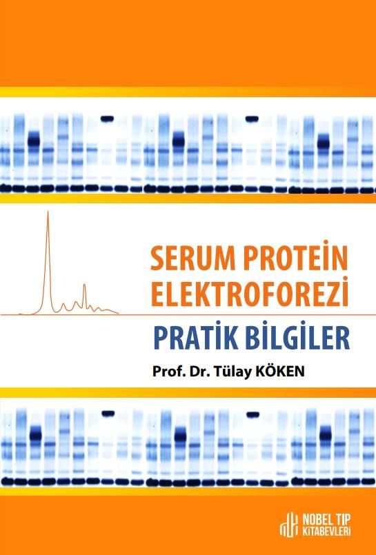 Serum Protein Elektroforezi: Pratik Bilgiler